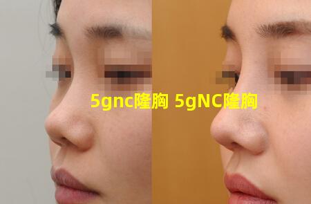 5gnc隆胸 5gNC隆胸